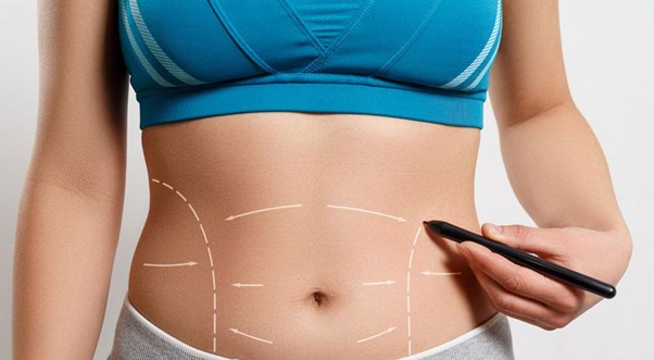 Body Contouring Surgery in Singapore